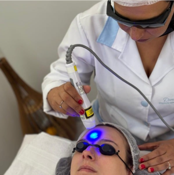 Domi Aguiar realizando procedimento facial com laser de alta frequência