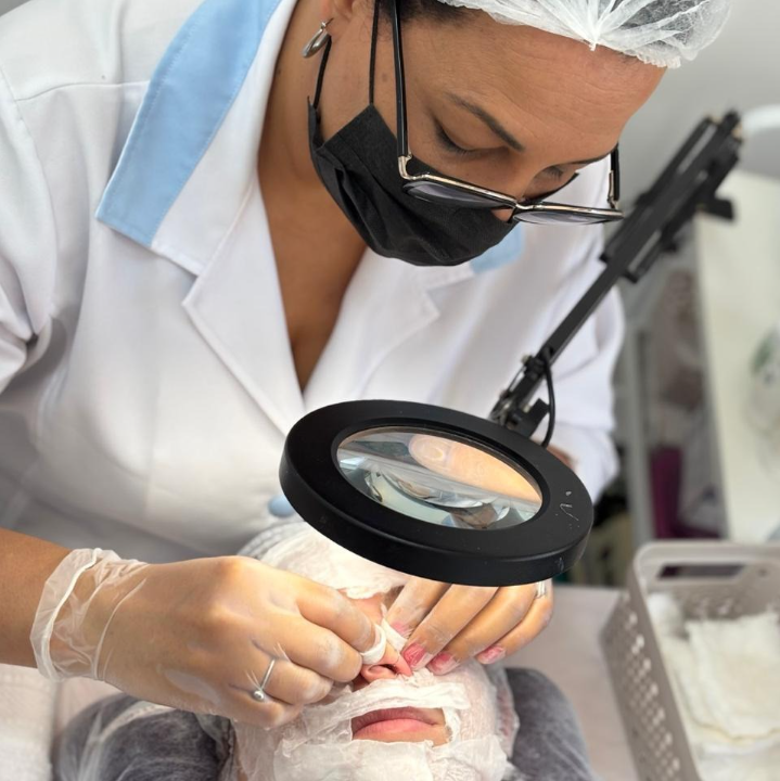 Domi Aguiar fazendo extração com lupa profissional de aumento